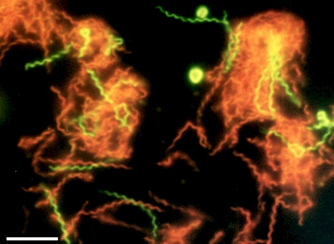 A microscopic photograph of fluorescent-stained <i>Spirochaeta americana</i> shows dead cells in red and living cells in green. Photo: Richard B. Hoover, Elena Pikuta, and Asim Bej, NASA/NSSTC University of Alabama at Huntsville, and the University of Alabama at Birmingham.